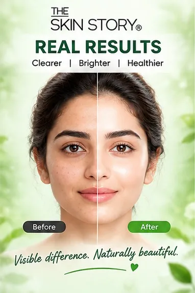 Glowing Moringa Kit 72gm thumbnail 7